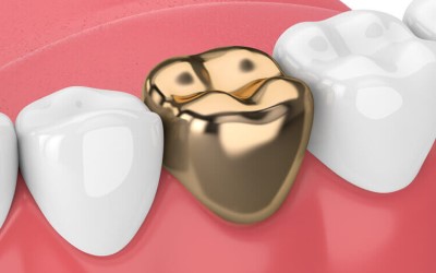 Metallic (Gold) Crown Metallic