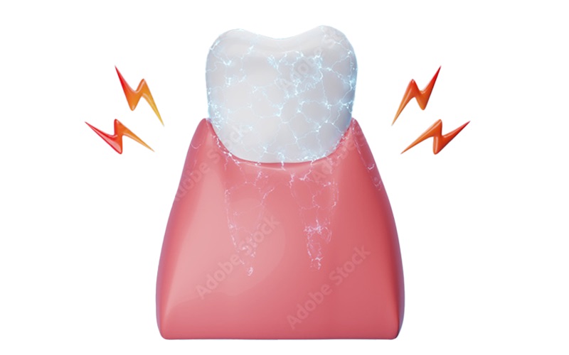 Set3-ToothSensitivity-800x500px-DS-23-May-24 Sensitivity